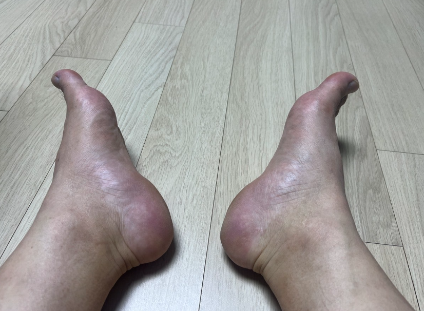 발 냄새 예방 양말의 선택 방법
