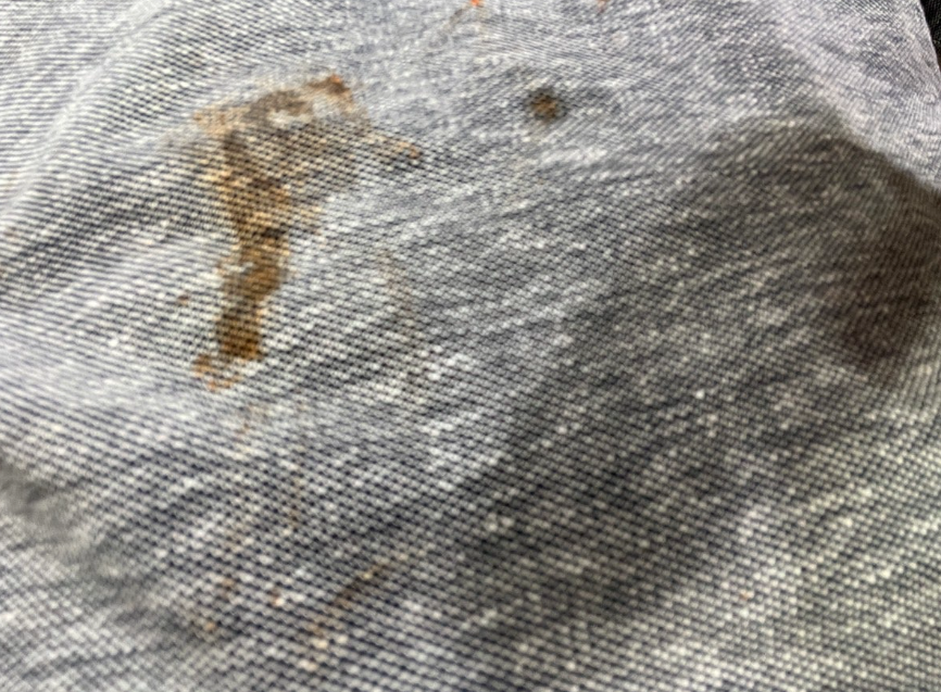 옷에 피 얼룩, 옷에 핏자국 이불 자국 지우는 방법