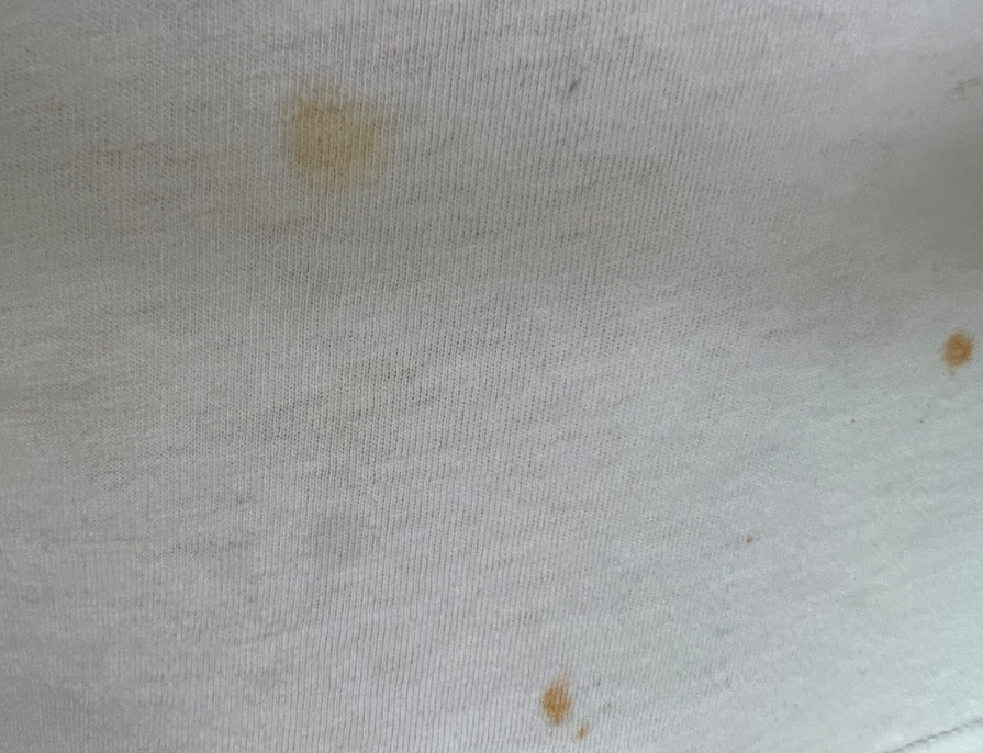 세탁후 얼룩 발생 원인과 옷 얼룩제거 방법