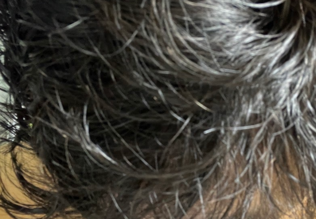 머리카락 빨리 자라는법 머리 기르는법 실천