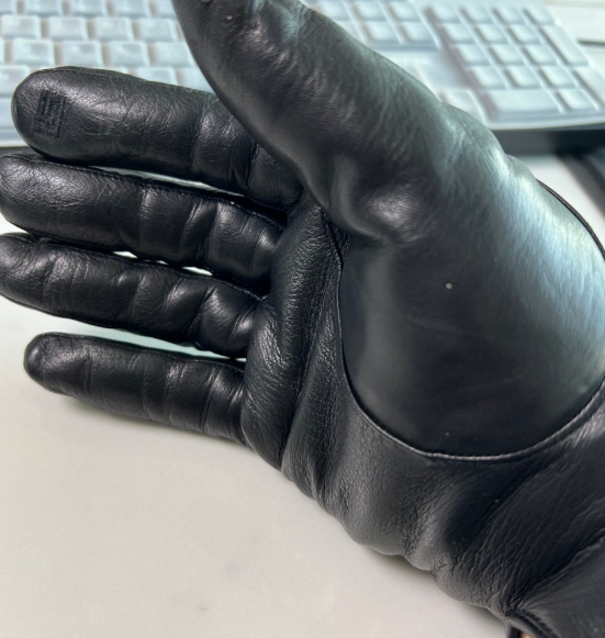 겨울 손 트는 이유 거칠고 갈라지는 손 피부관리1