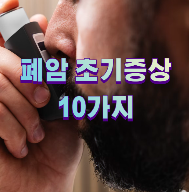 폐암 초기증상 10가지1
