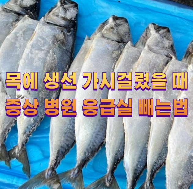 목에 생선 가시걸렸을 때 증상 병원 응급실 빼는법1